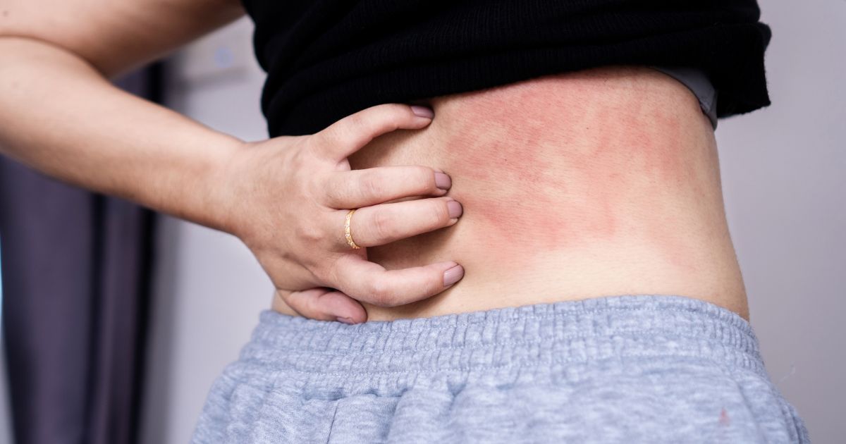 cold-allergy-adults-causes-treatment